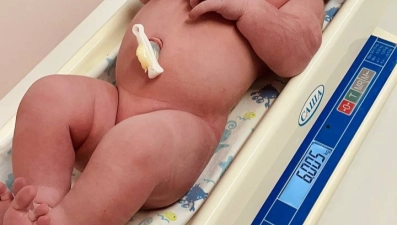 Девочка весом 6 килограммов родилась в Липецке