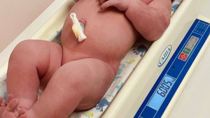 Девочка весом 6 килограммов родилась в Липецке