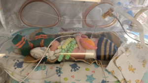 В Липецке спасли малыша со сложнейшим пороком сердца