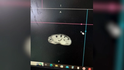 В Липецке врачи спасли кисть ребенка 