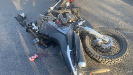 Два подростка без мотошлемов серьезно пострадали в аварии в Липецке 