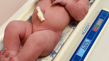 Девочка весом 6 килограммов родилась в Липецке