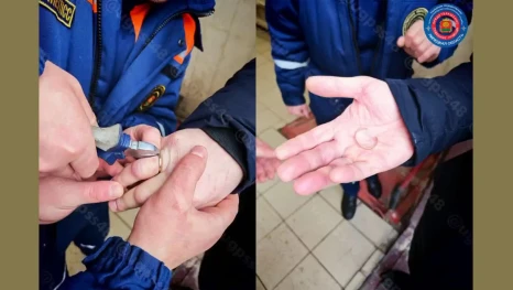 Спасатели помогли липчанину снять застрявшее кольцо