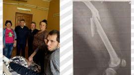 Липецкие врачи 5 недель боролись за жизнь парня из Рязани